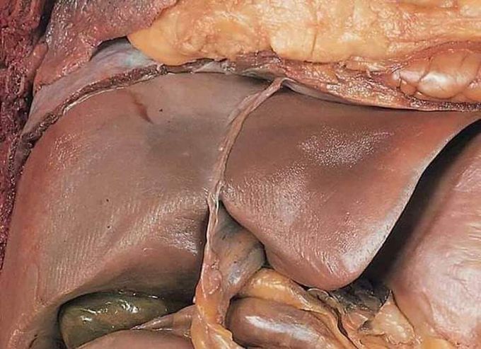 #What organ is this ?