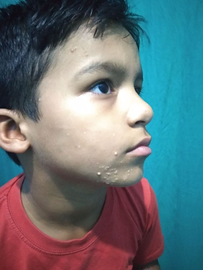 What is the Diagnosis??