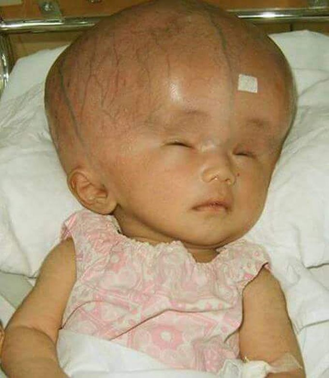 Diagnosis and treatment?