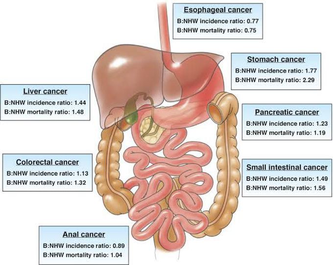 GI TRACT CARCINOMA