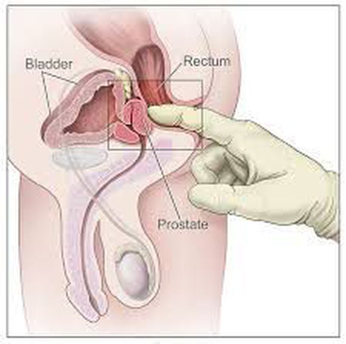Rectum anatomy and position