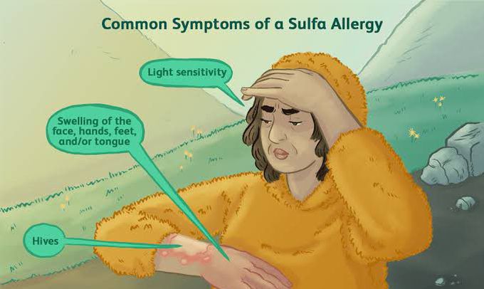 These are the symptoms of Sulfa allergy