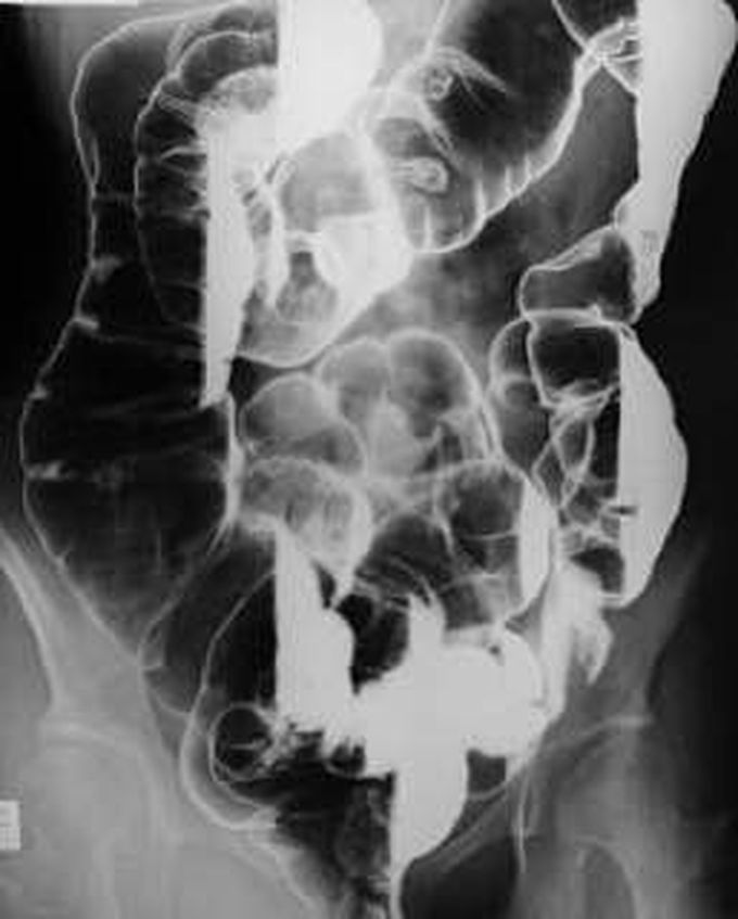 Diagnosis please