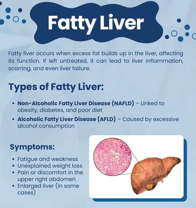 Fatty Liver