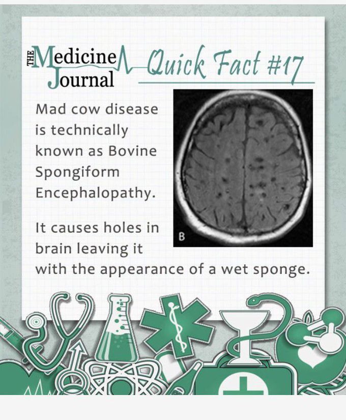 Interesting facts