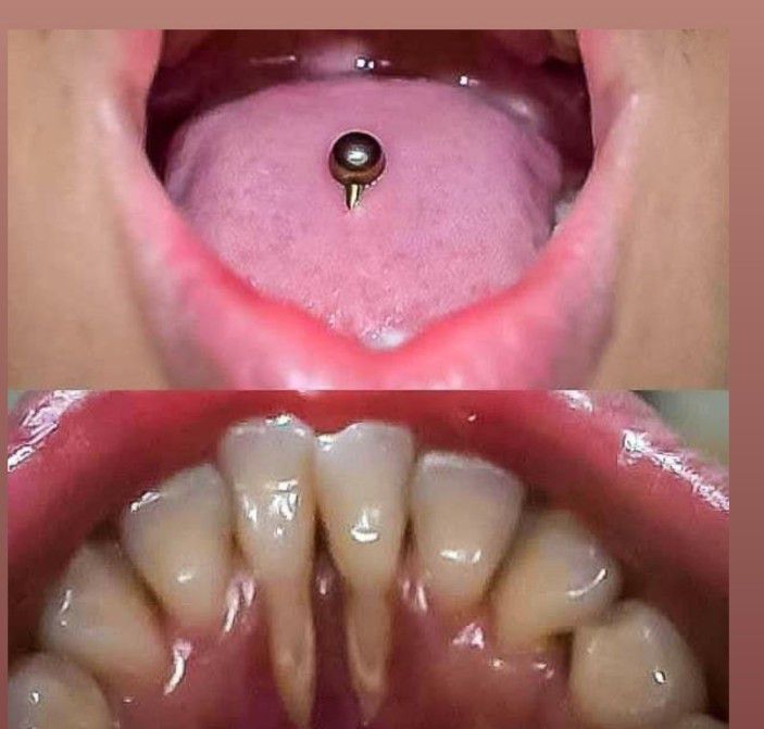 How Long Do Tongue Piercing Swelling Last