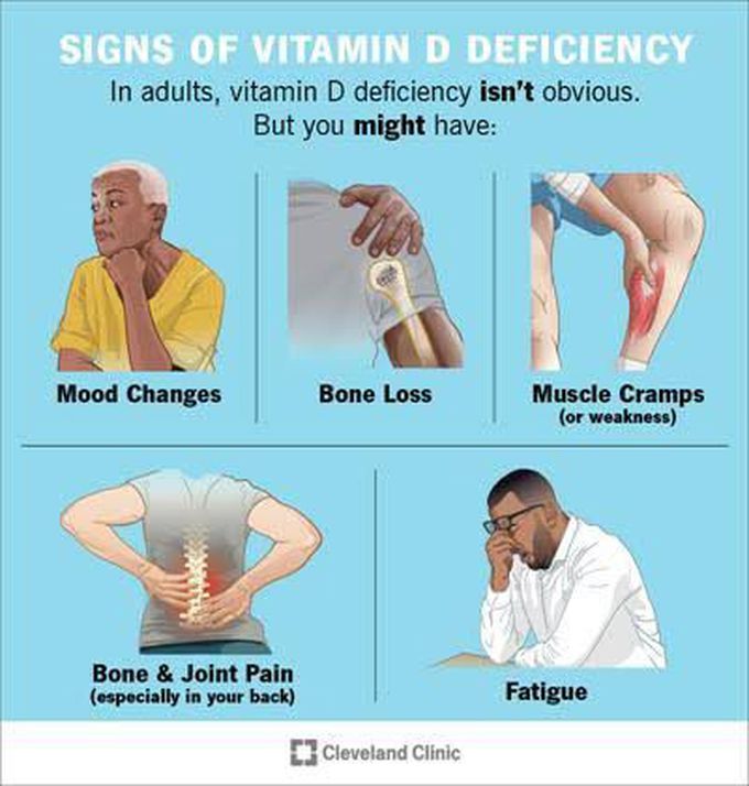 Vitamin d deficiency