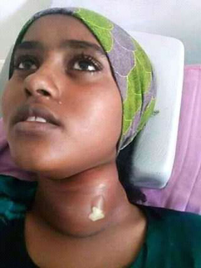 Please diagnosis, treatment, caused, prevention
