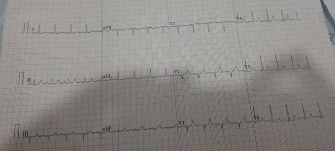 Diagnosis?
