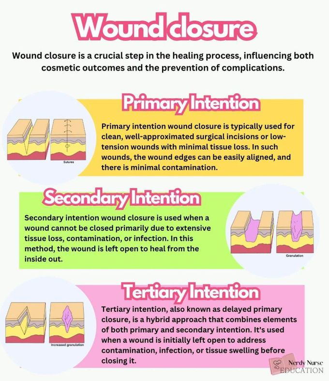 Wound Closure