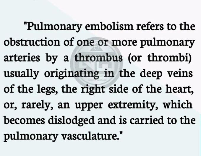 Pulmonary Embolism