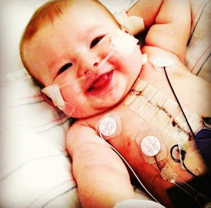 A beautiful smile after a heart transplant!!!