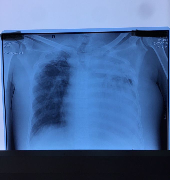 Can someone tell what the DX is?