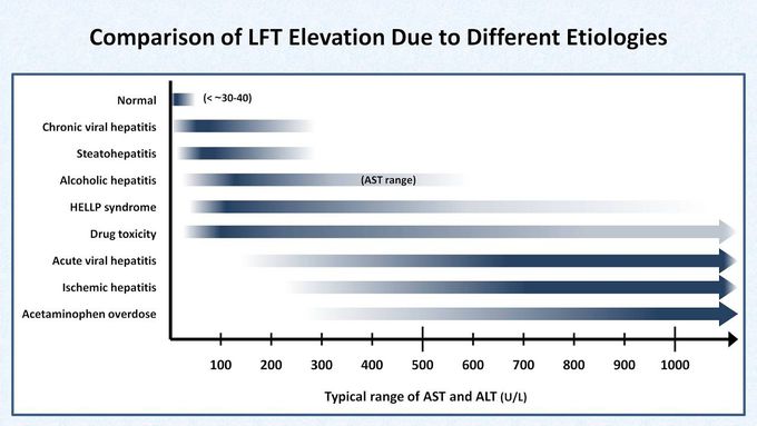 Interpretation of LFTs (Liver Function Tests)