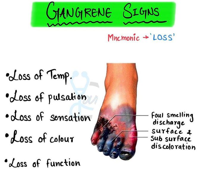 Gangrene Signs