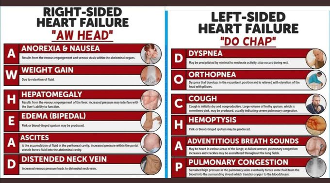 Congestive Heart Disease