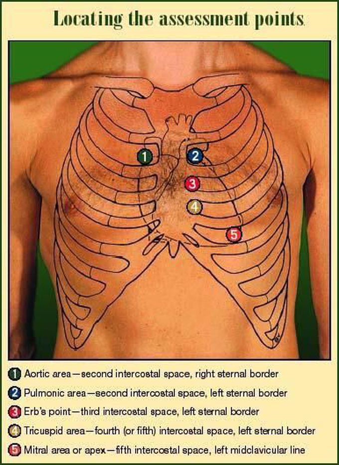 Heart sounds