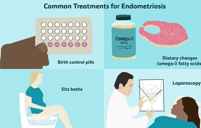 Treatment for Endometriosis