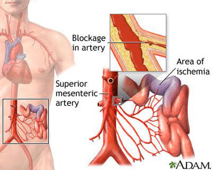 Symptoms of epididymitis