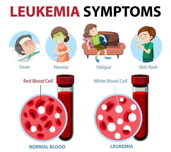 Symptoms of leukemia