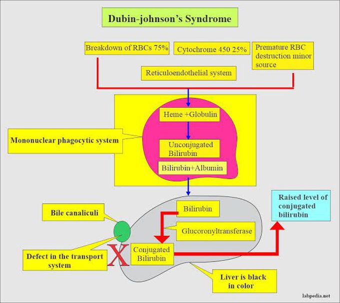 Dubin johnson syndrome