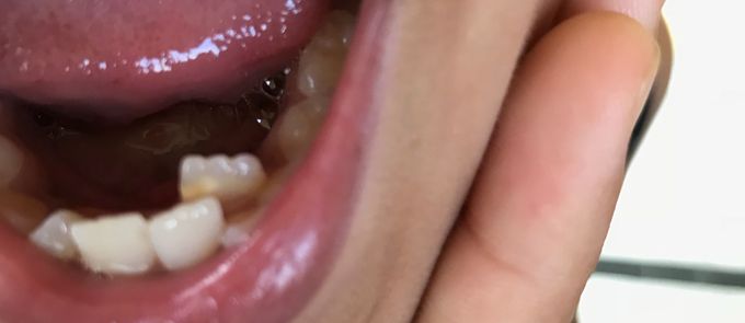 Diagnosis??