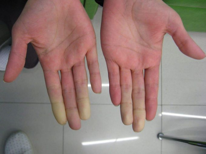 What is your diagnosis??