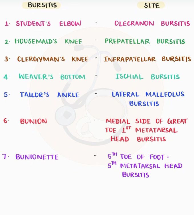 Bursitis