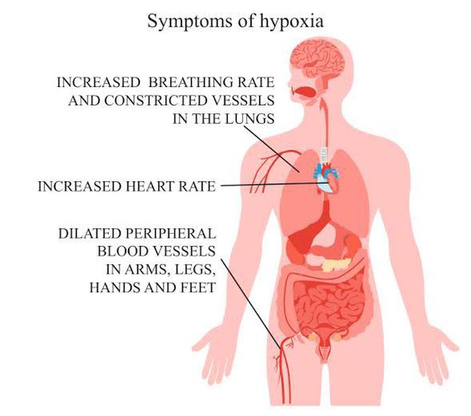 Symptoms of hypoxia