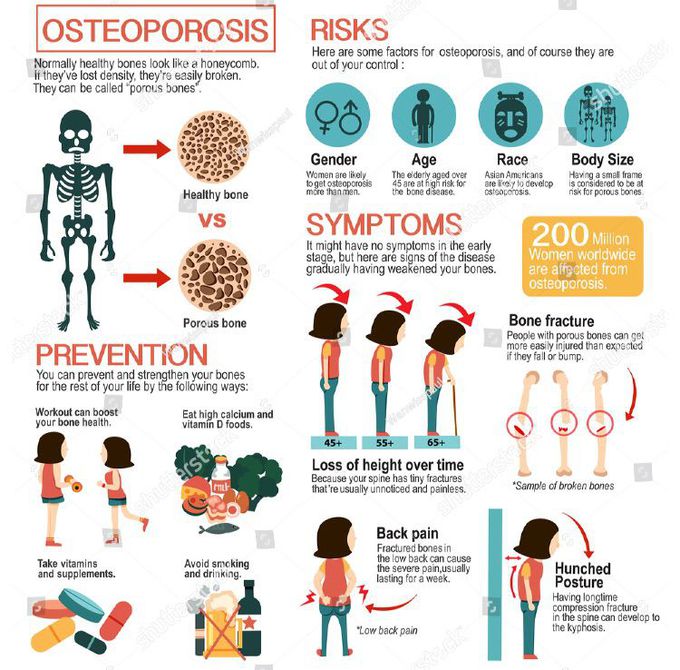 Osteoporosis