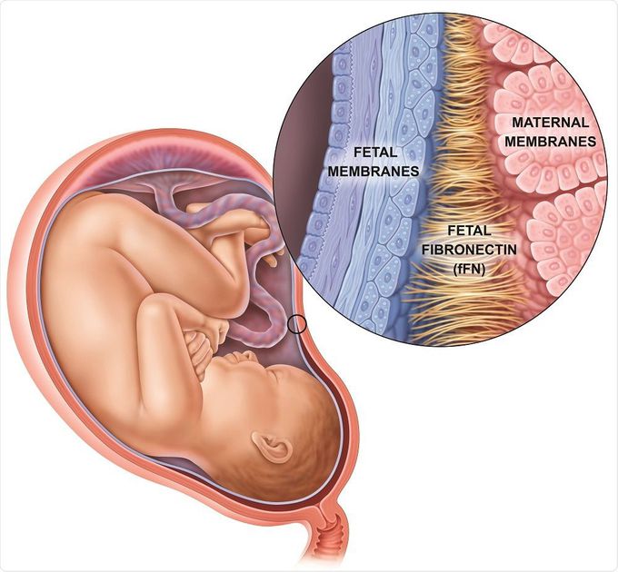 Fetal Fibronectin