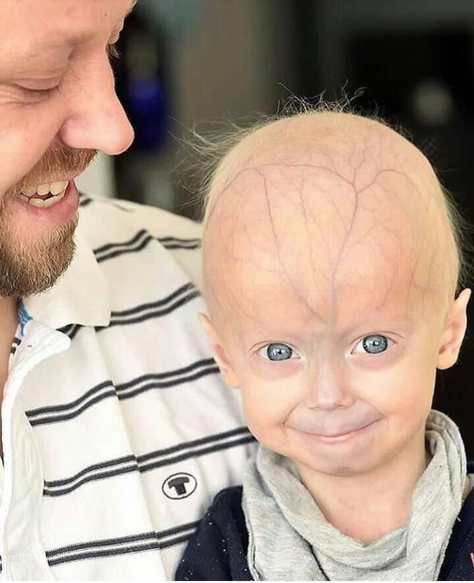 Diagnosis ?