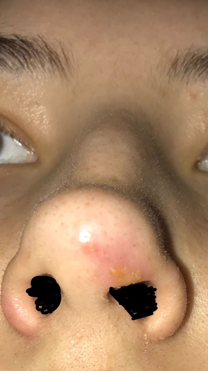 what is this?