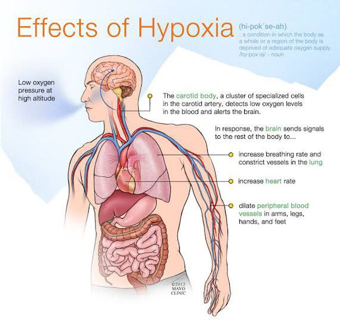 These are the effects of hypoxia