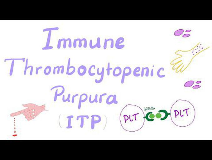 Simplified pathology of Immune Thrombocytopenia Purpura (ITP)