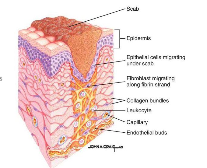 Fibroplastic stage of wound healing