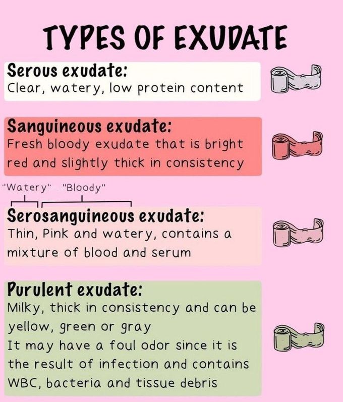 Types of Exudate