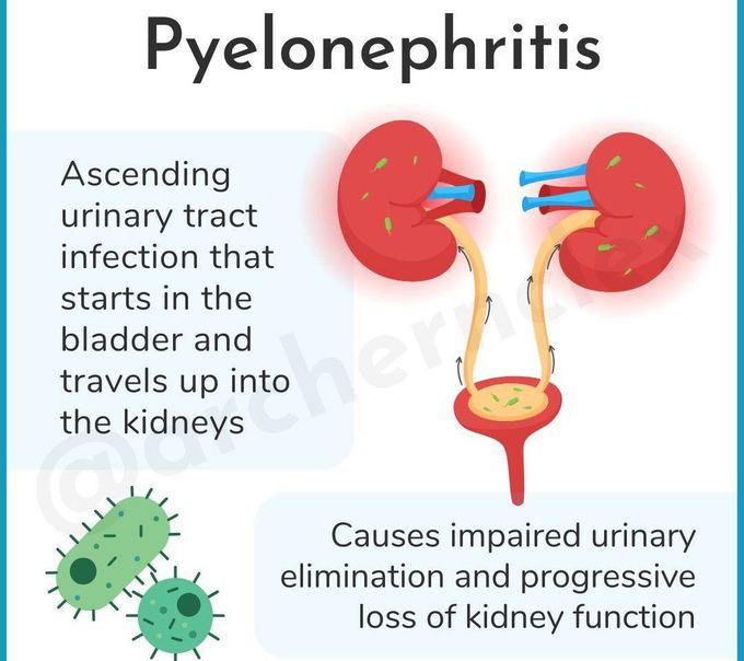 Pyelonephritis