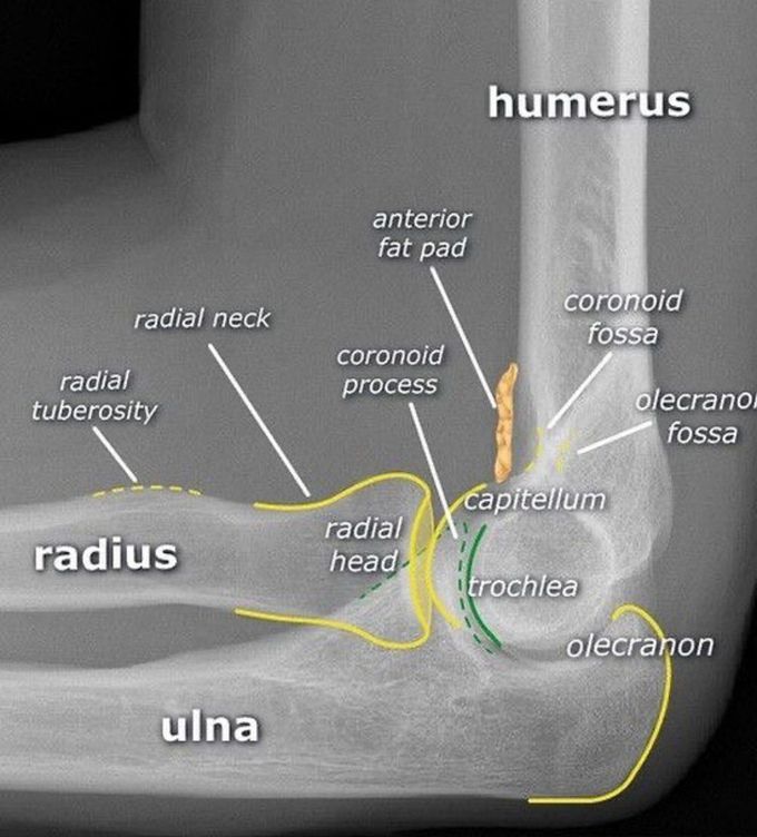 Elbow Joint Radiology
