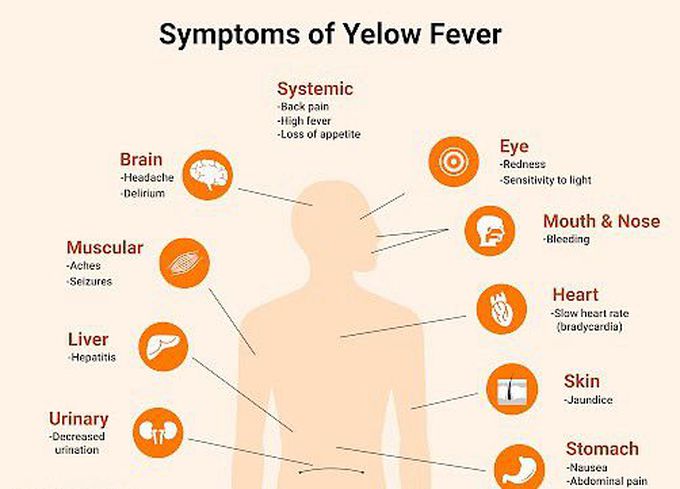 Symptoms of yellow fever