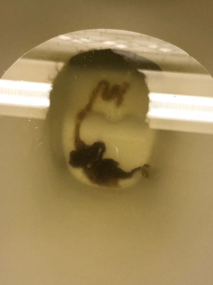 Intestinal Parasite?