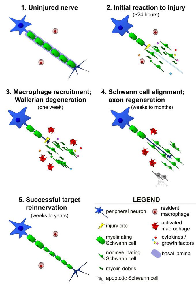 Injury to neuron