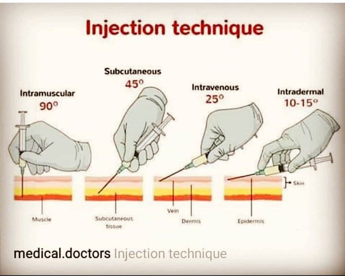 Injection