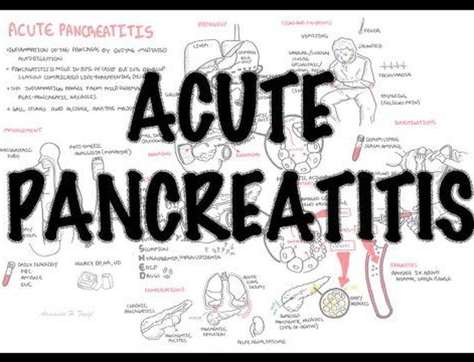 Acute Pancreatitis - Overview (signs and symptoms, pathophysiology, investigations, treatment)