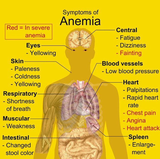 Symptoms of anemia