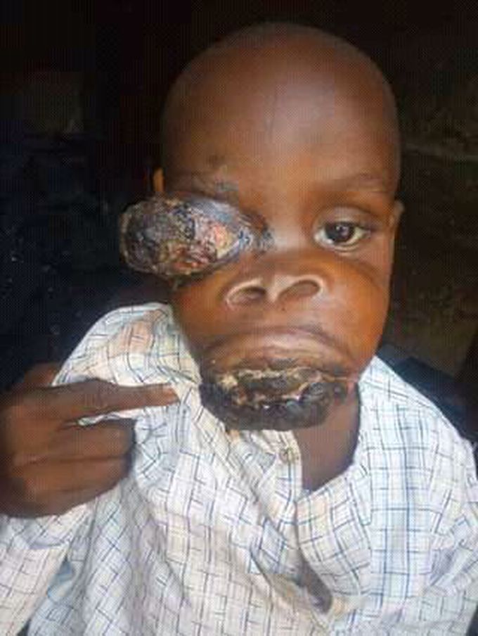 Please diagnosis and treatment.