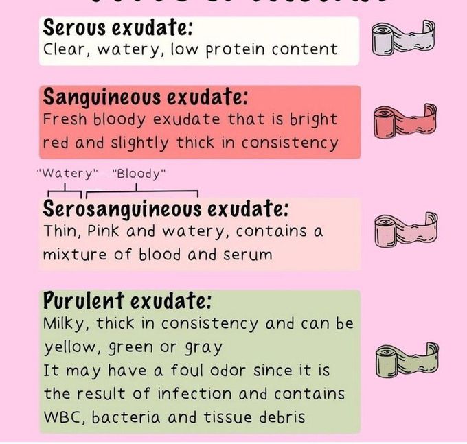 Types of Exudate