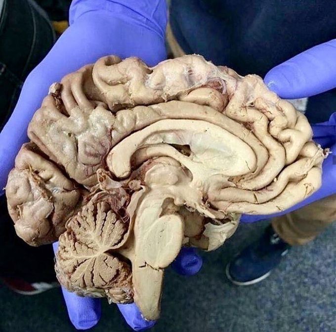 Brain