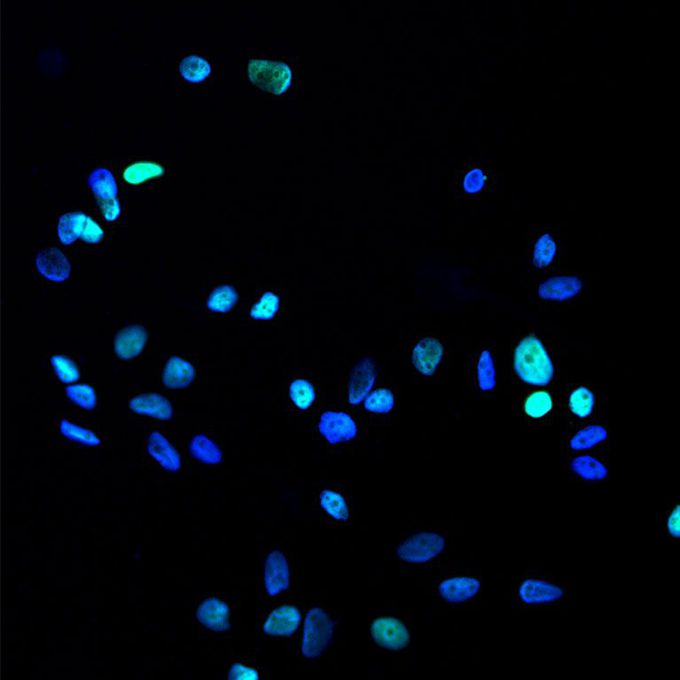 Salk scientists curb growth of cancer cells by blocking access to key nutrients