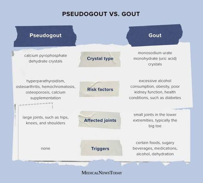 Pseudogout vs gout